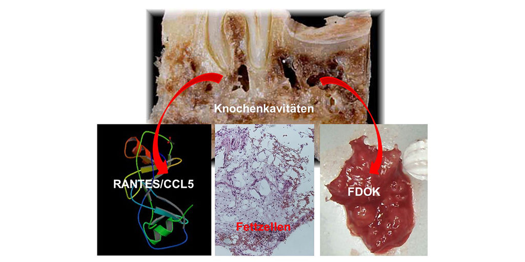 ICOSIM Osteoimmunologie