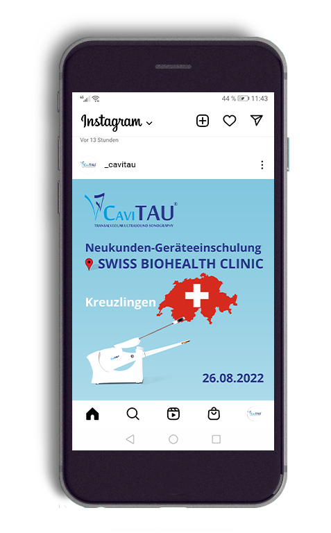 Mobile_Insta_SDS