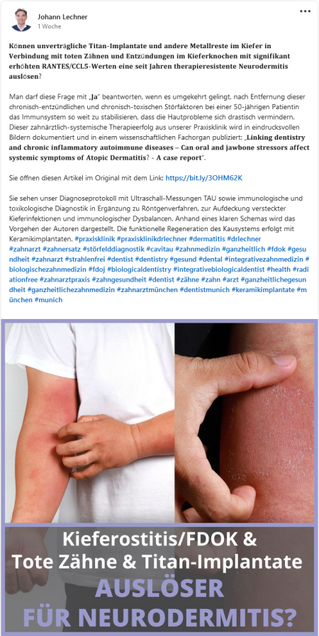 Linking-dentistry-and-chronic-inflammatory-autoimmune-diseases