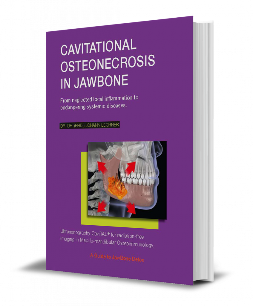 Cavitational_Osteonecrosis_Jawbone_NEW
