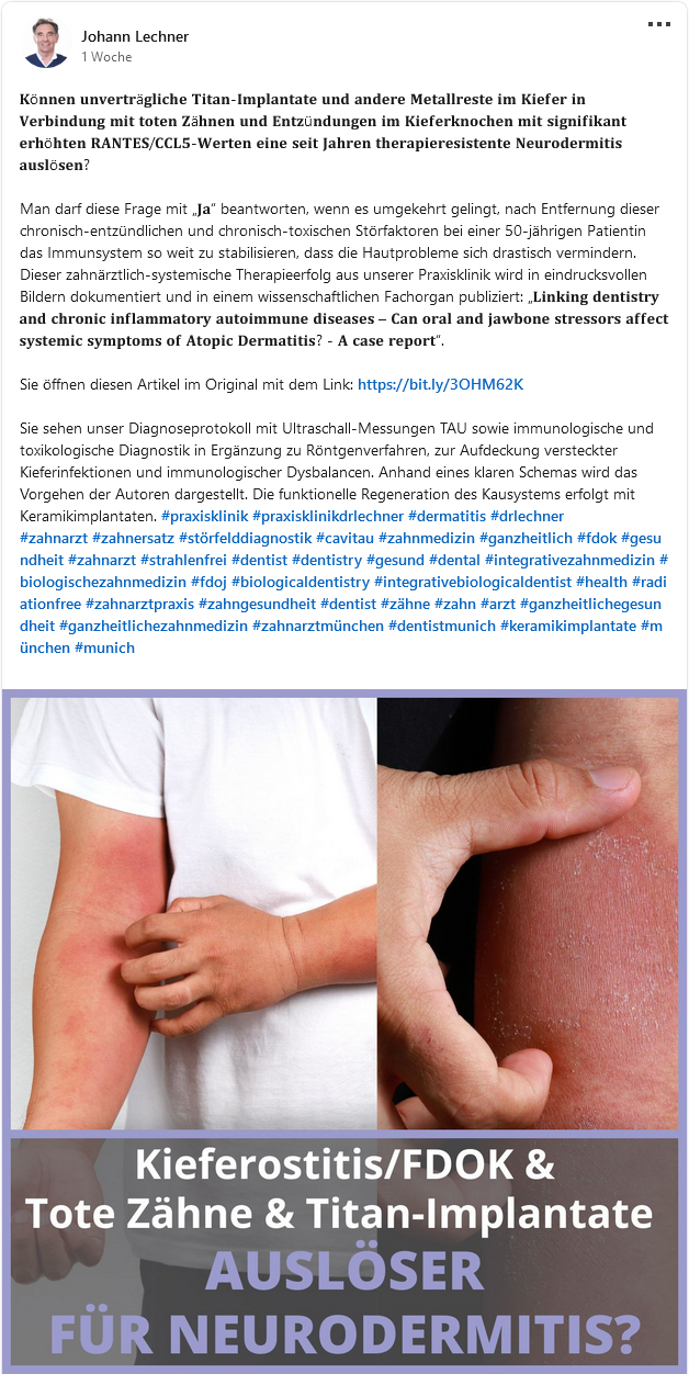 Linking-dentistry-and-chronic-inflammatory-autoimmune-diseases