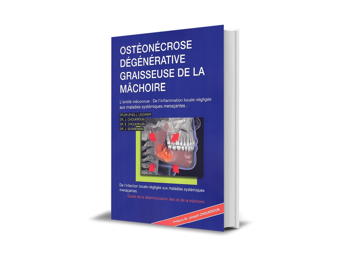 Buchcover „Ostéonécrose Cavitaire de l’os de la mâchoire“