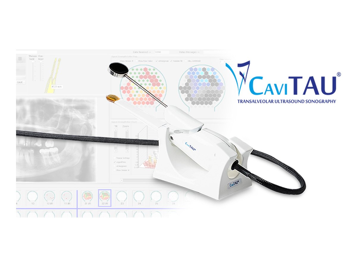 CaviTAU® Gerät für die transalveoläre Ultraschall-Sonographie