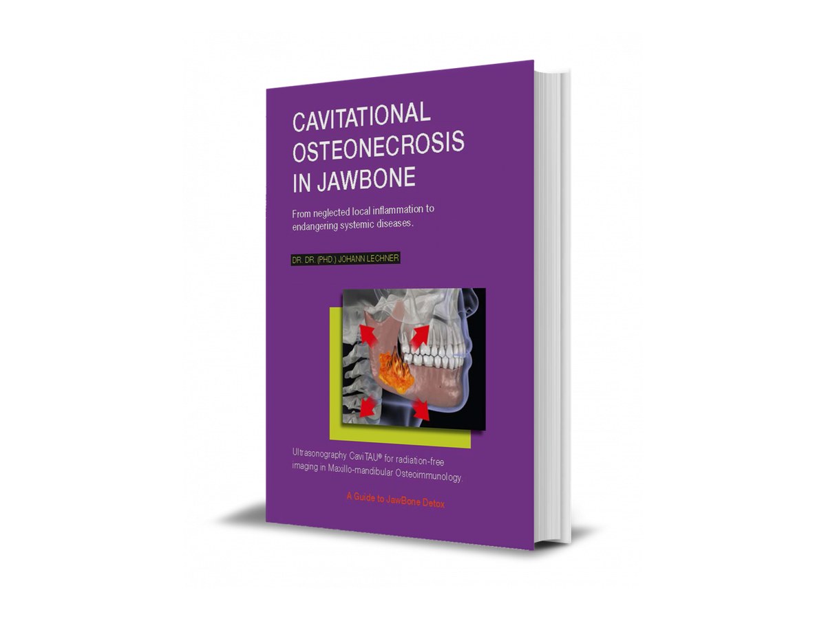 Book cover “Cavitational Osteonecrosis in Jawbone”