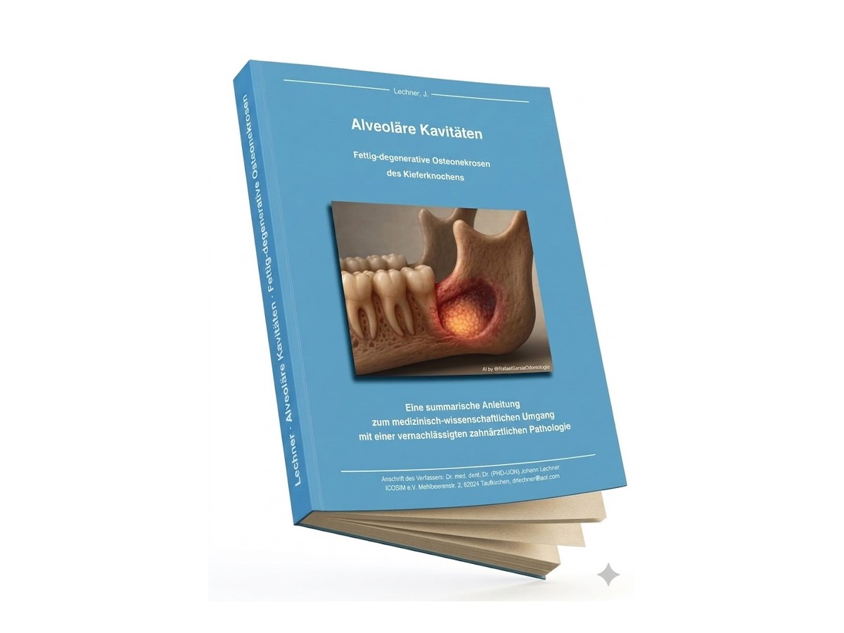 Cubierta del libro «Cavitaciones alveolares»